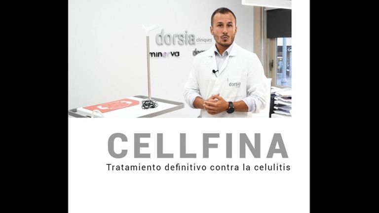 Cellfina