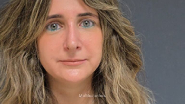 Rinoplastia 14 días despues