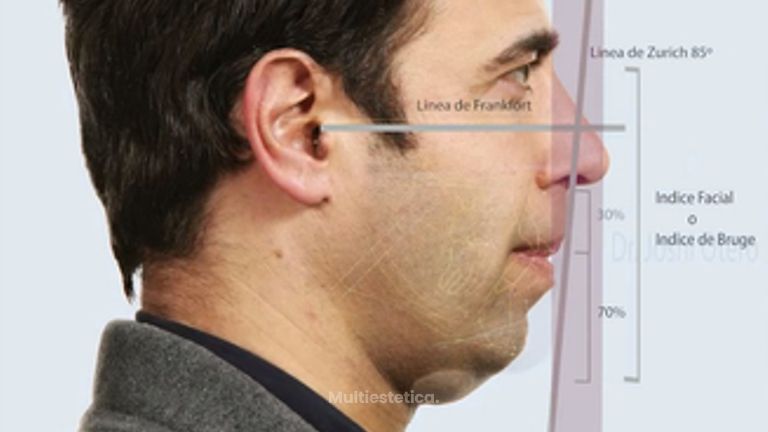 Estudio de Armonización facial en el hombre 