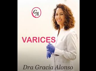 Varices - Tratamiento Escleroterapia (Dra. Gracia Alonso)
