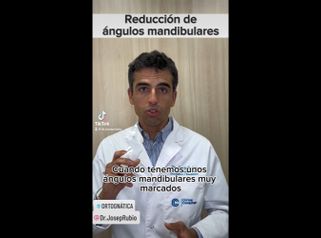Cirugía Maxilofacial - Dr. Josep Rubio Palau