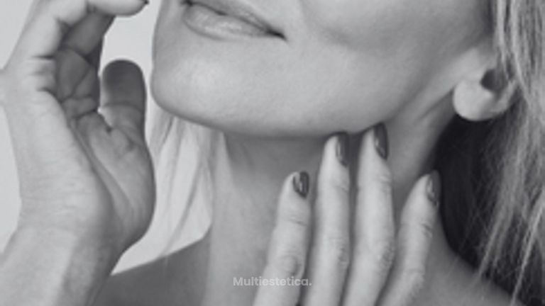 3A PART LIFT ENCOSCDEEP