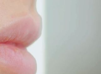 Colocación Labios - Clínica Montecarmelo