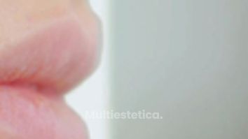Colocación Labios - Clínica Montecarmelo