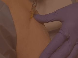 Flacidez, piel apagada y sin firmeza… ¡Olvídate de eso!Con nuestro tratamiento antiaging para brazos