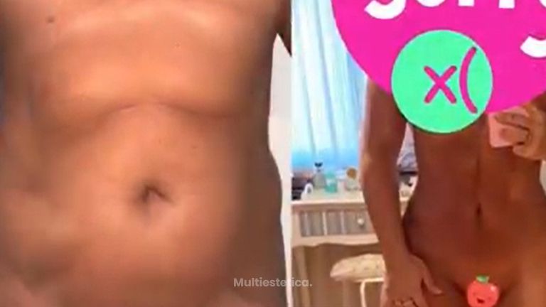 Abdominoplastia - Dr. Sergio Morral