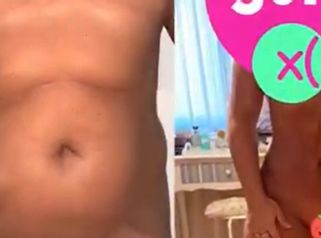Abdominoplastia - Dr. Sergio Morral