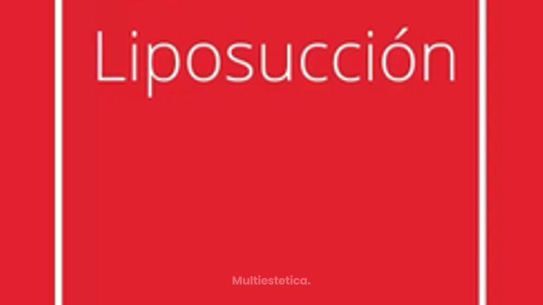 Testimonio Liposucción - Grupo Médico Clínicas Massana