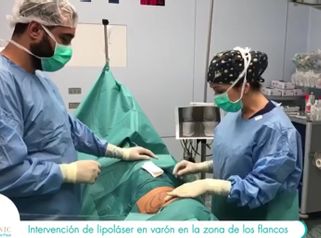 Liposucción