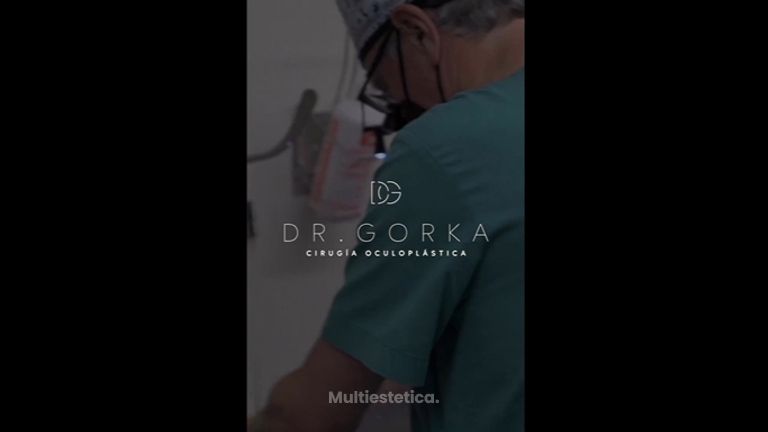 Blefaroplastia - Dr. Gorka Martinez Grau