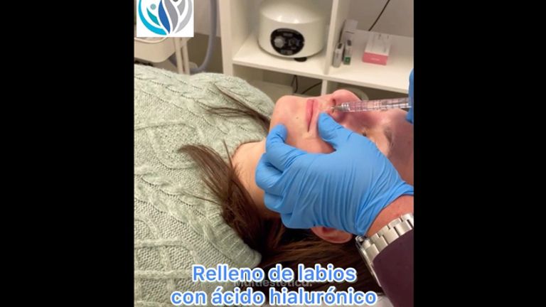 Aumento de labios - Centro Médico Primo De Rivera