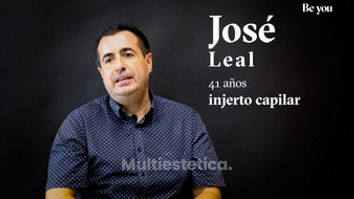 Injerto capilar: José nos cuenta su experiencia