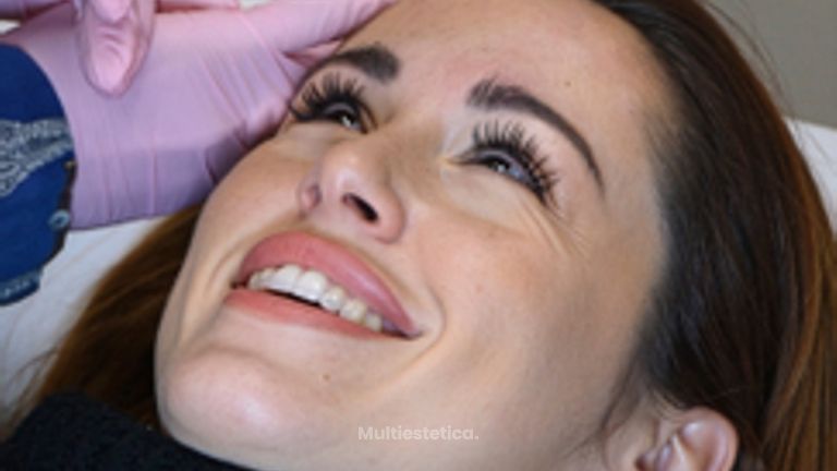 Eliminación y prevención de arrugas - Clínica Opción Médica