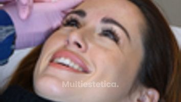 Eliminación y prevención de arrugas - Clínica Opción Médica