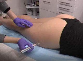 Clínica Lasery
