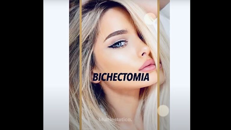 Bichectomía - Saona Clínicas De Estética