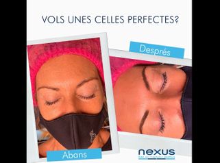 Micropigmentación - Clínica Nexus