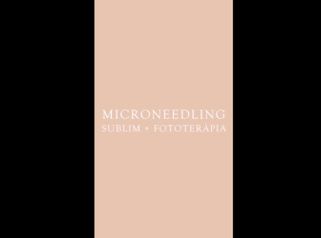 Microneedling - Clínica Nexus