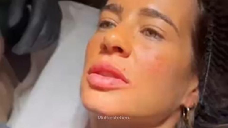 HIDRATACION DE LABIOS