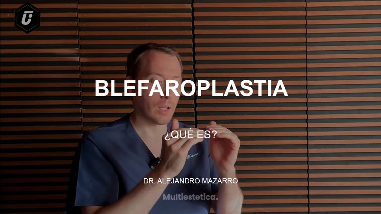 Blefaroplastia - Clínica Tufet