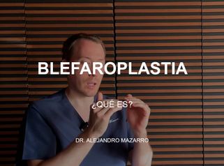 Blefaroplastia - Clínica Tufet