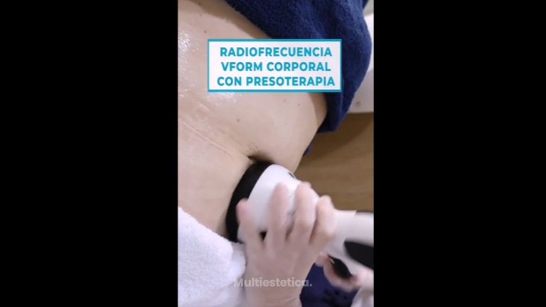 Radiofrecuencia + Presoterapia Corporal - Clínicas Estymed