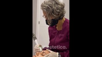 Radiofrecuencia facial - Clínica Suárez