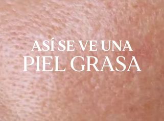 Tipos de Piel