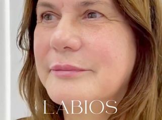 Clínica Carlos Gómez - Labios