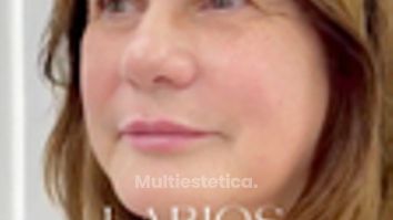Clínica Carlos Gómez - Labios