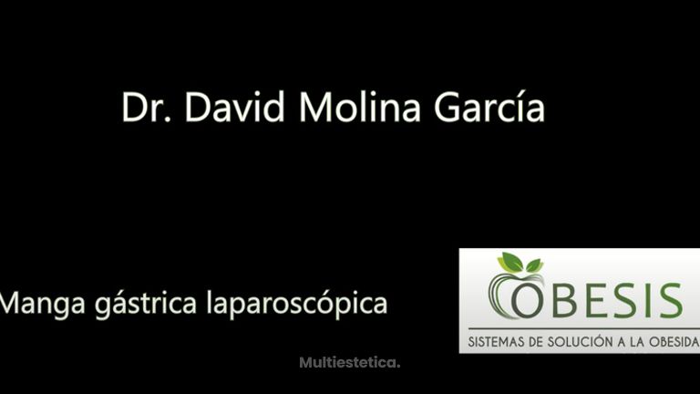Manga gástrica laparoscópica - Dr. David Molina García - Clínica Obesis