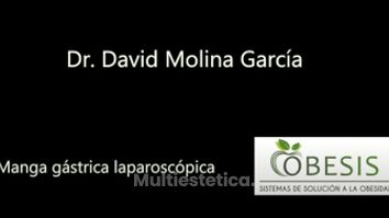 Manga gástrica laparoscópica - Dr. David Molina García - Clínica Obesis