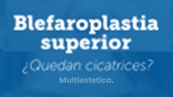 Cicatrices en la blefaroplastia superior