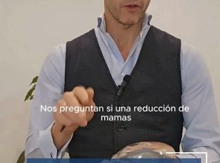 Reducción de mamas ¿Quedará bien sin prótesis?