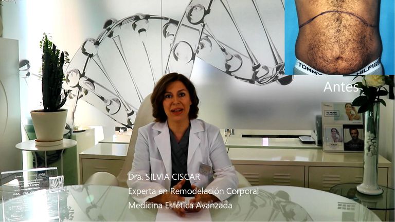 Hidrolipoclasia 4D - Dra. Silvia Ciscar