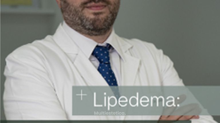 Enfoque multidisciplinar para tratar el lipedema