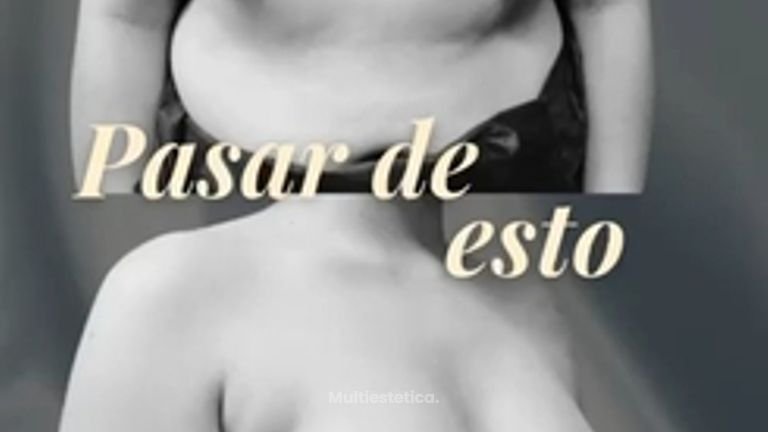 Aumento de pecho