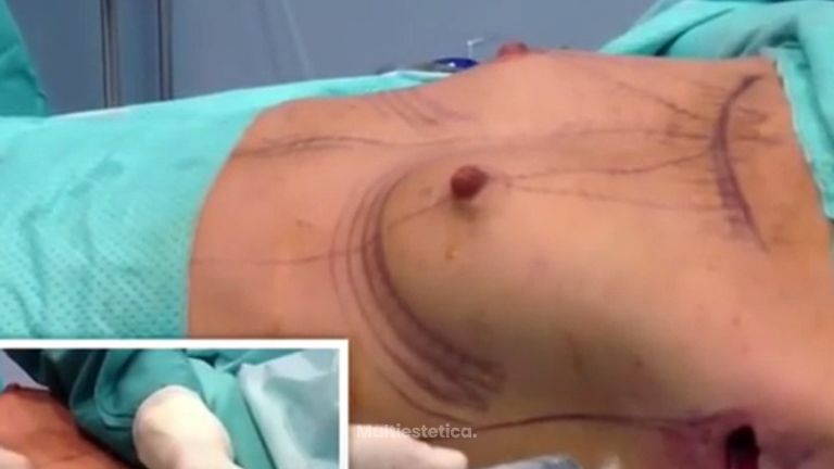 Aumenta tu pecho y mejora tu figura
