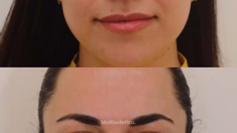 El tratamiento estrella para prevenir arrugas ✨