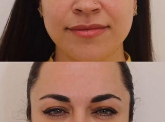 El tratamiento estrella para prevenir arrugas ✨