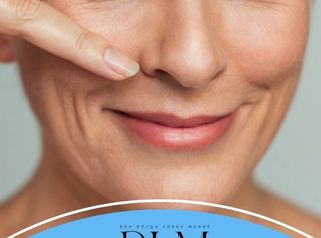 La blefaroplastia es una cirugía que mejora la apariencia de los párpados