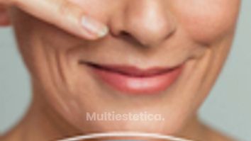 La blefaroplastia es una cirugía que mejora la apariencia de los párpados