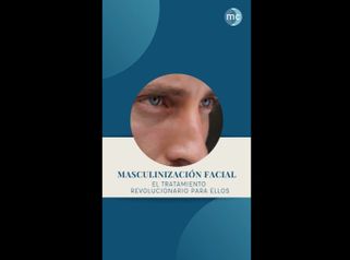 Masculinización facial - Medcare Health & Beauty