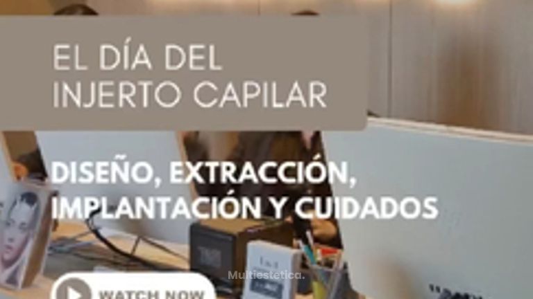 🗓️ ¿Qué pasa el día de la cirugía capilar