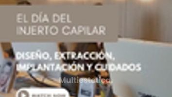 🗓️ ¿Qué pasa el día de la cirugía capilar