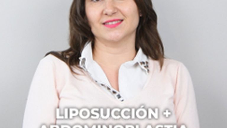 Abdominoplastia - Clínica Opción Médica