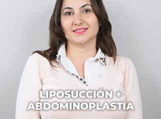 Abdominoplastia - Clínica Opción Médica
