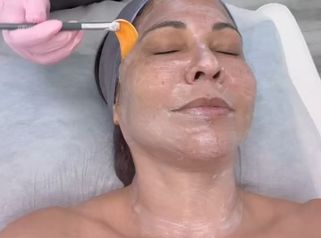 Dermapen
