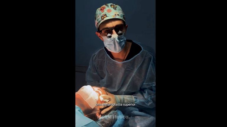 Blefaroplastia superior - Dr. Jiménez Ortiz