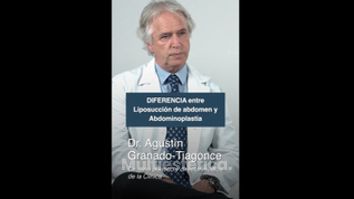 Diferencia entre liposucción abdominal y abdominoplastia - Clínica Granado Tiagonce